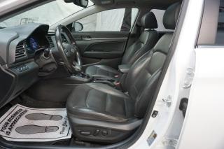 2020 Hyundai Elantra ULTIMATE 1.8L *1 OWNER* NAVI CAMERA BLUETOOTH ALL HEATED SEATS BLIND ALLOYS - Photo #15