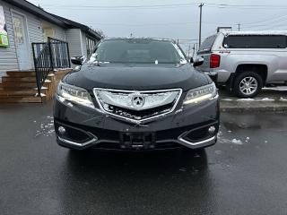 2017 Acura RDX elite pkg - Photo #2