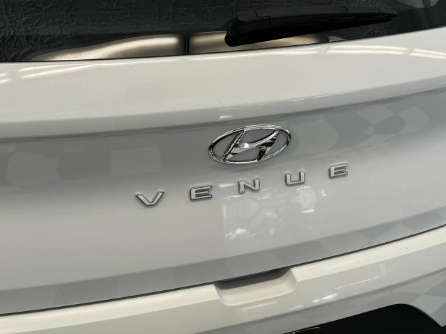 2021 Hyundai Venue Trend+Remote Start+Roof+ApplePlay+Heated Seats+CAM Photo63