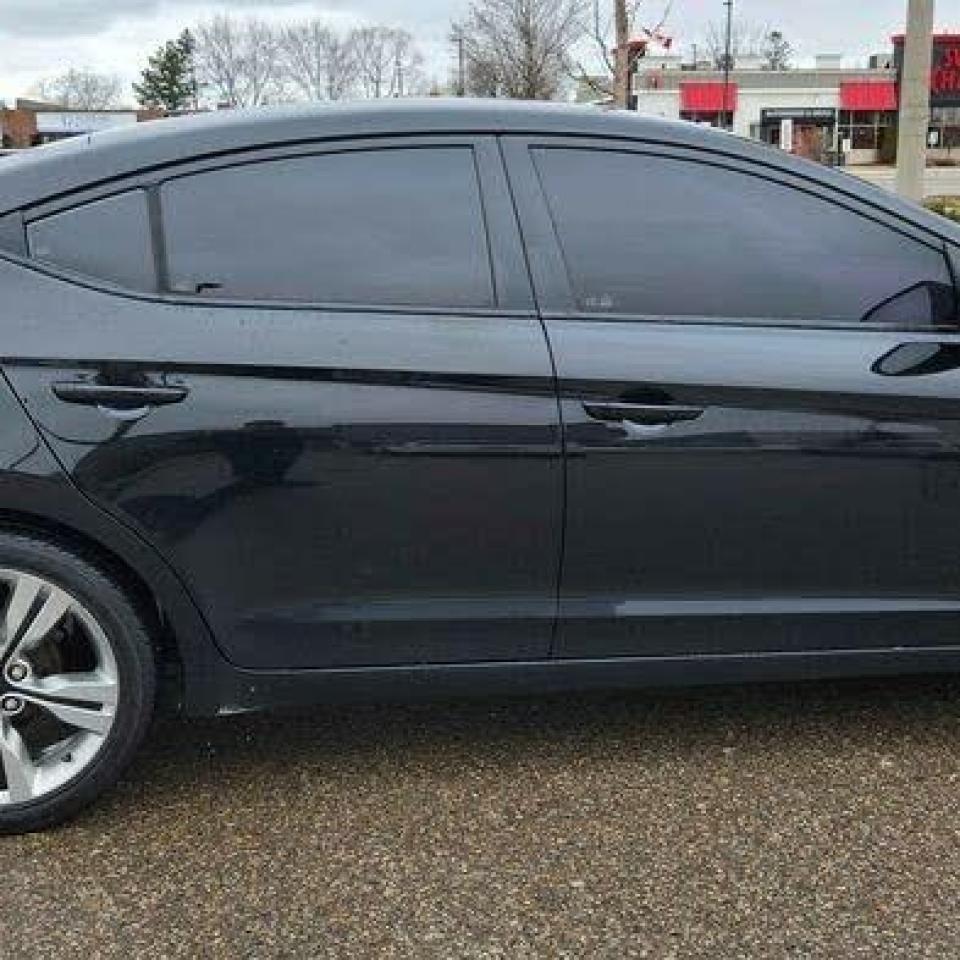 2017 Hyundai Elantra SE - Photo #3