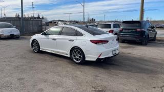 2019 Hyundai Sonata ULTIMATE*2.0T*WINTERS*LEATHER*ALLOYS*CERTIFIED - Photo #3