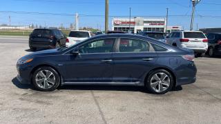 2018 Hyundai Sonata ULTIMATE*PLUG IN HYBRID*ONLY 68,000KMS*CERTIFIED - Photo #2