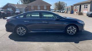 2018 Hyundai Sonata ULTIMATE*PLUG IN HYBRID*ONLY 68,000KMS*CERTIFIED - Photo #6