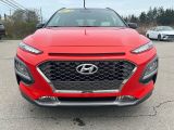 2018 Hyundai KONA Trend Photo24