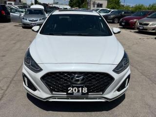 Used 2018 Hyundai Sonata SPORT for sale in North York, ON