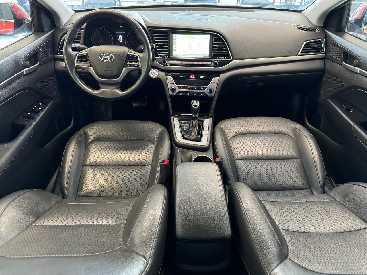 2017 Hyundai Elantra Limited+New Tires+Brakes+Roof+Camera+HeatedLeather - Photo #2