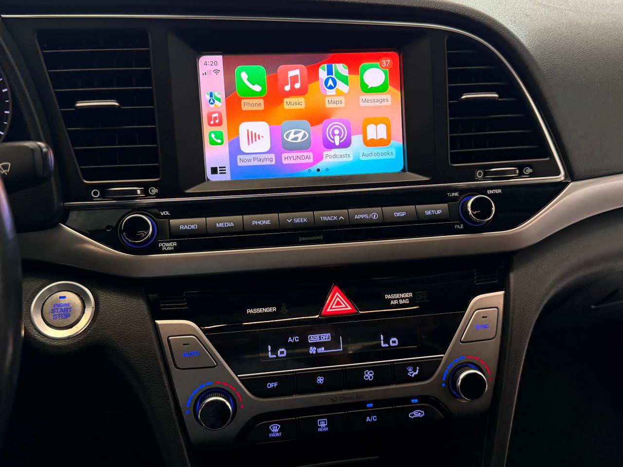 2017 Hyundai Elantra GLS+Sunroof+Blind Spot+A/C+Camera+CLEAN CARFAX - Photo #12