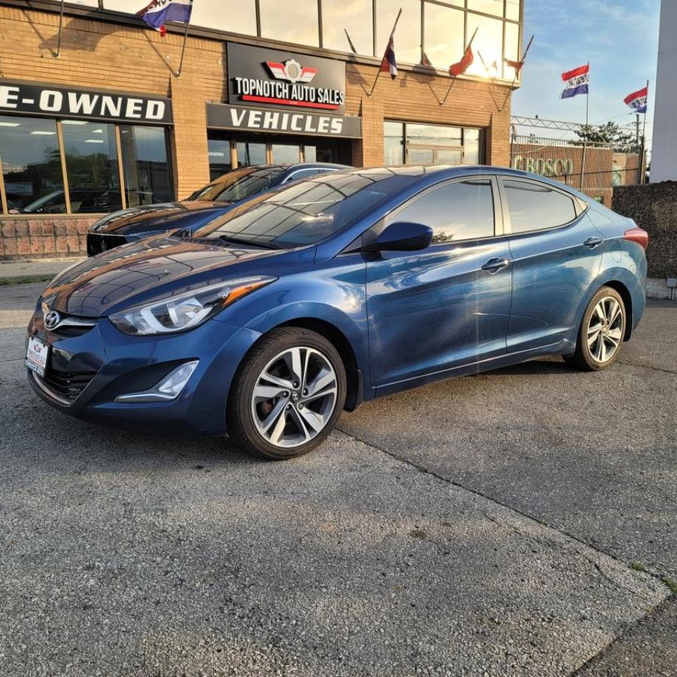 2016 Hyundai Elantra Sport - Photo #3