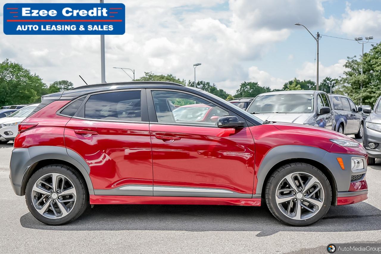 2020 Hyundai KONA 1.6T Trend Photo3