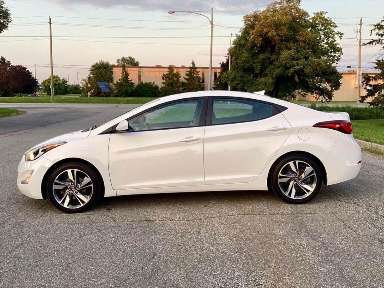 2016 Hyundai Elantra Sport Appearance Photo3