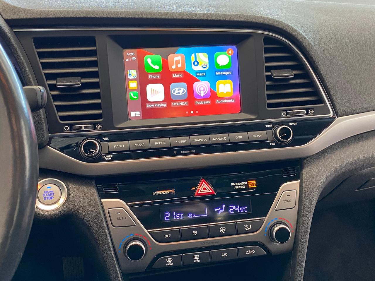 2017 Hyundai Elantra GLS+Sunroof+New Tires+Brakes+ApplePlay+Camera+A/C - Photo #12