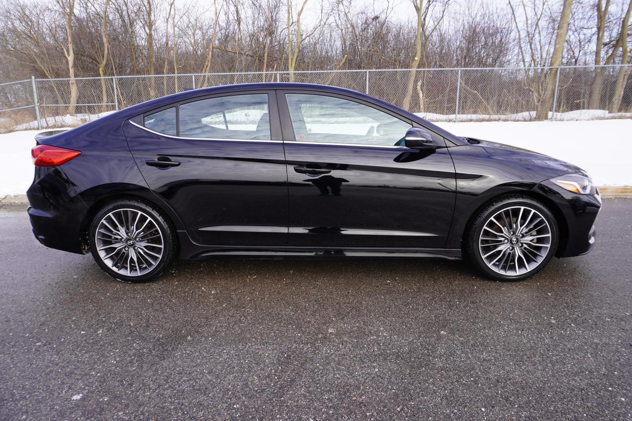 2018 Hyundai Elantra SPORT / MANUAL / NO ACCIDENTS / SUPER FUN DRIVER!! Photo4