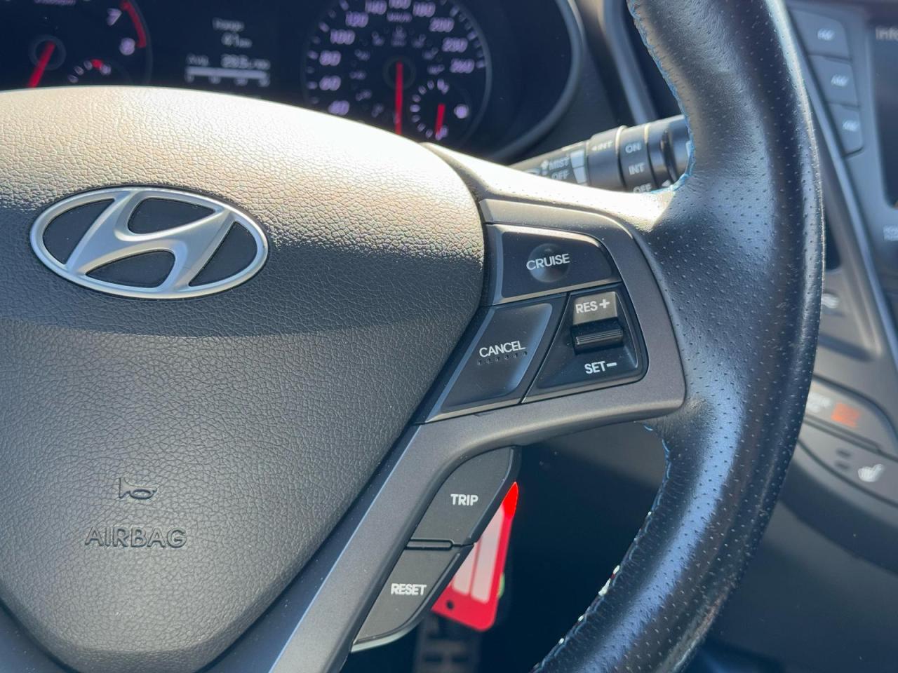 2016 Hyundai Veloster RALLY EDITION | TURBO | 6 SPEED | CLEAN CARFAX | Photo17