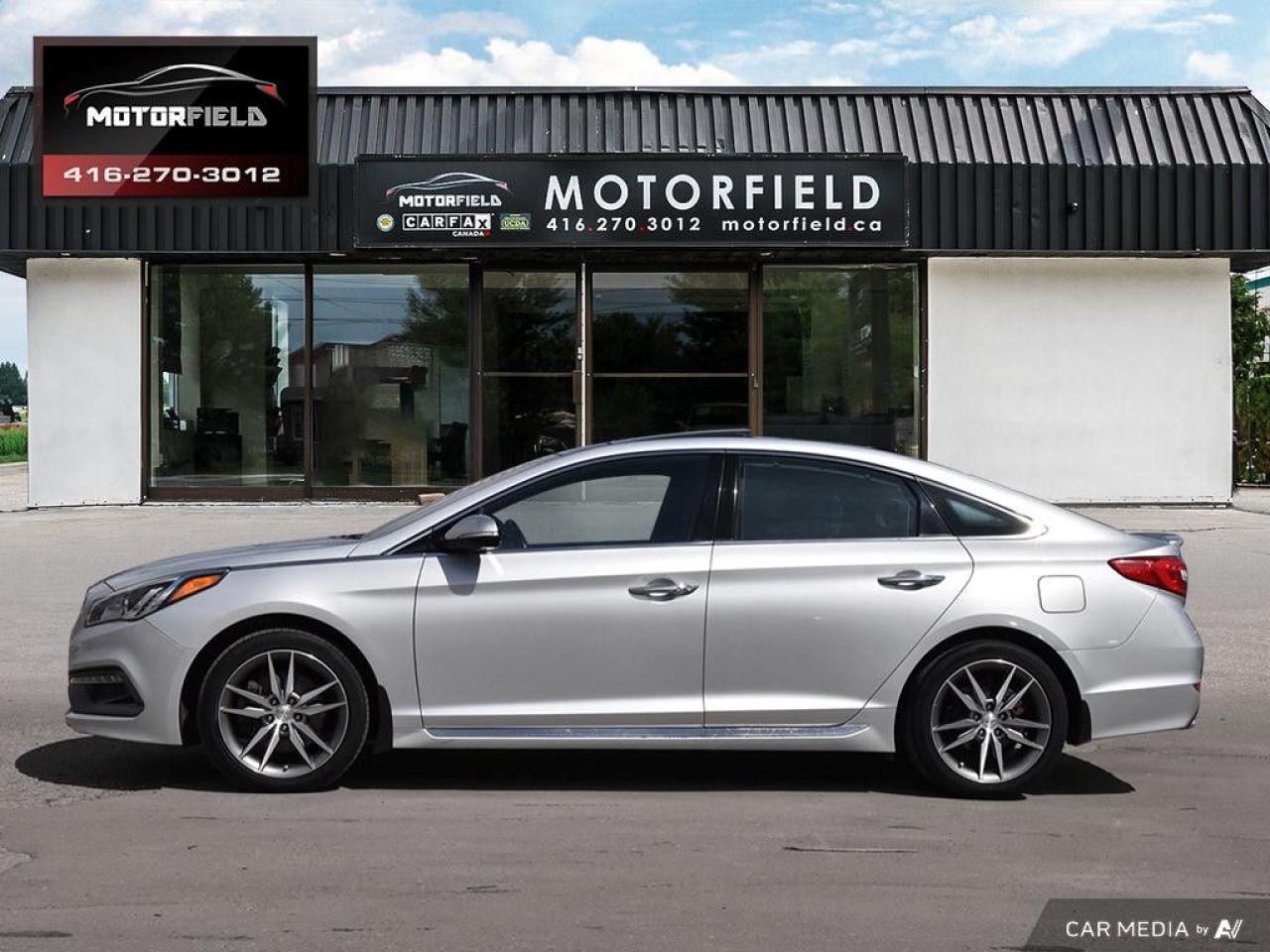 2017 Hyundai Sonata 2.0T Sport Ultimate *Accident Free, Sunroof, Loaded* Photo2