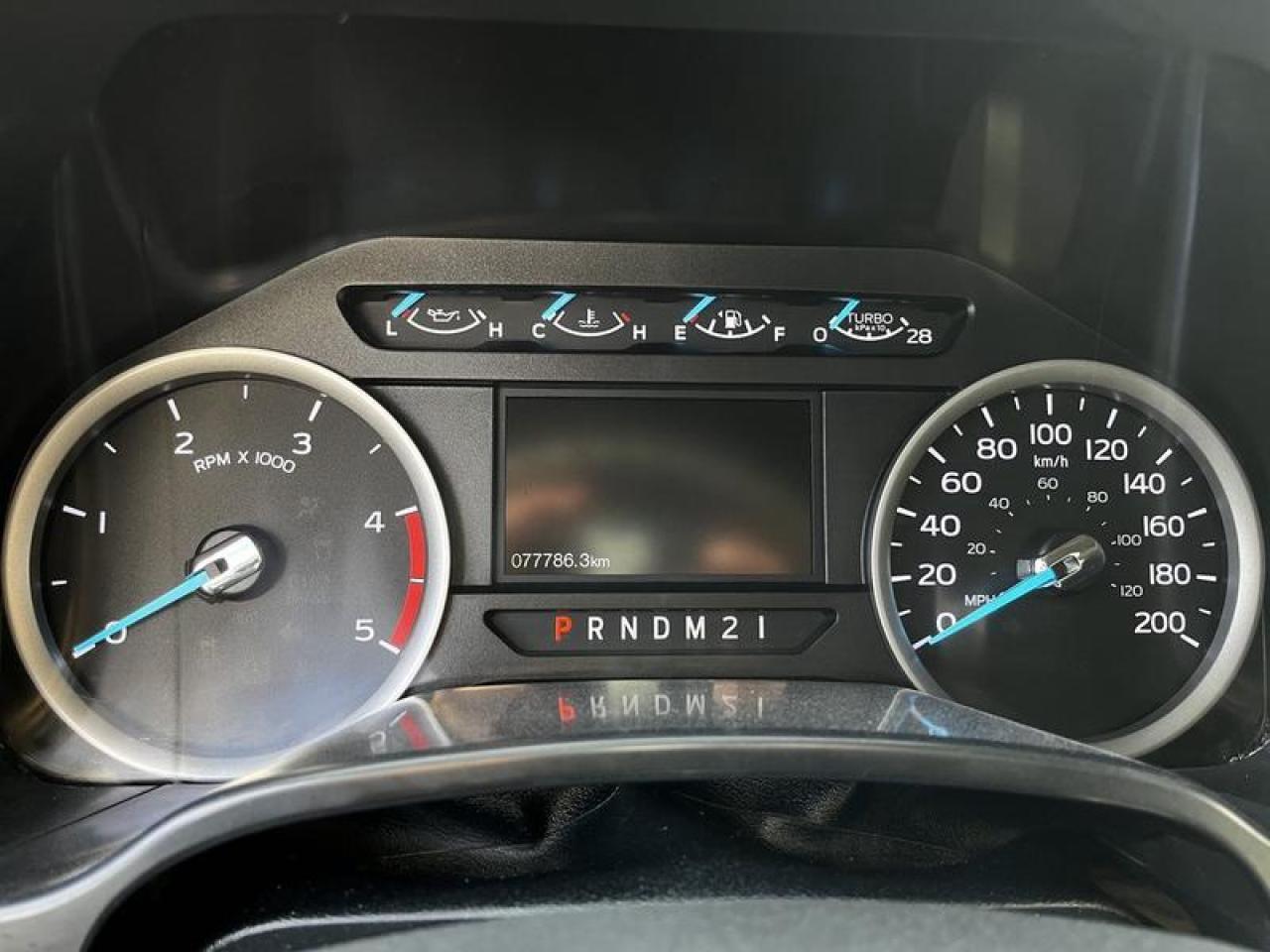 12379215