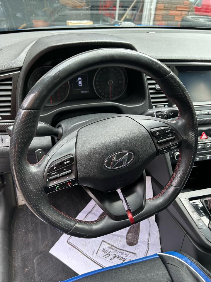 2017 Hyundai Elantra Sport - Photo #6
