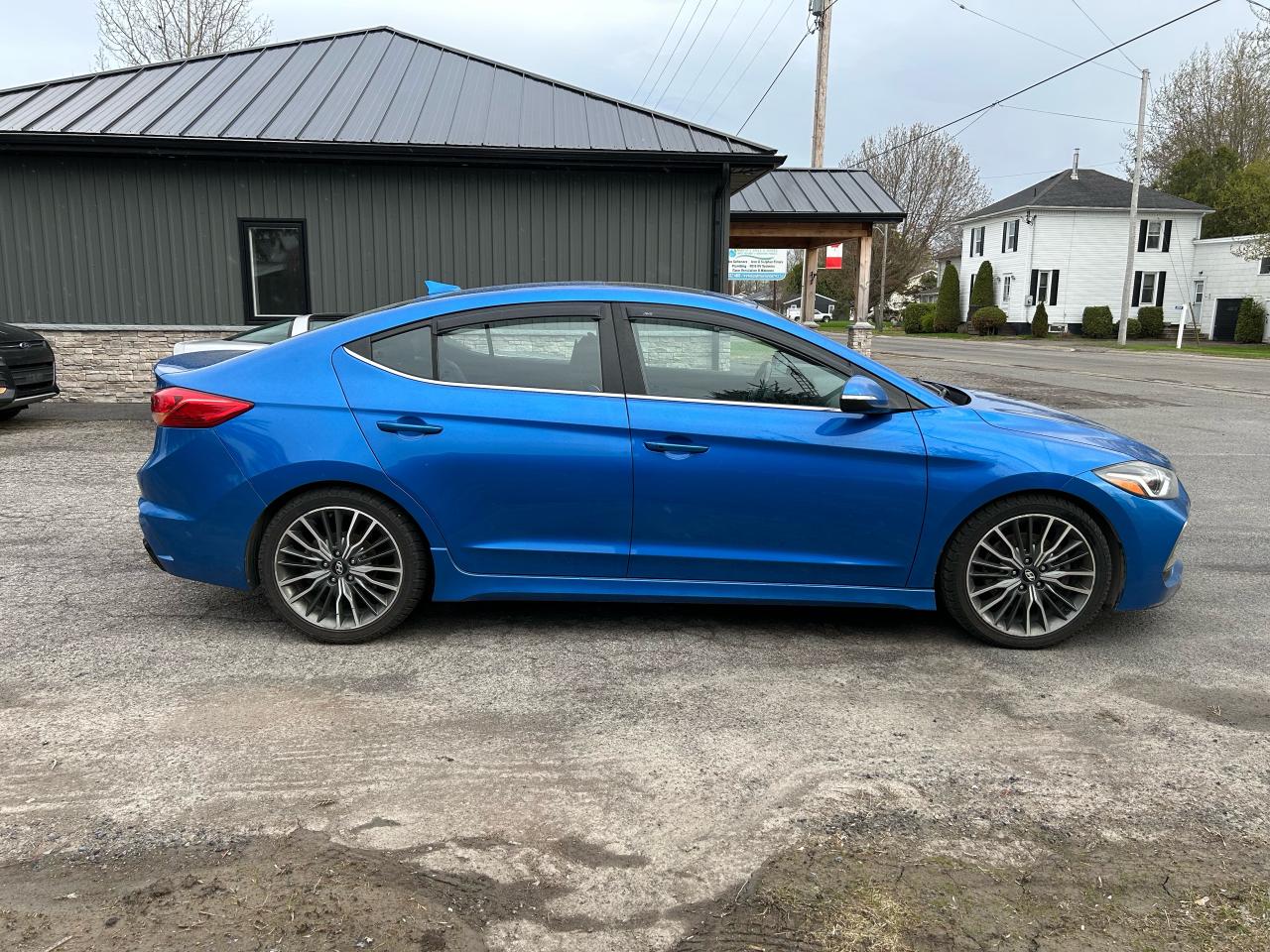 2017 Hyundai Elantra Sport - Photo #3