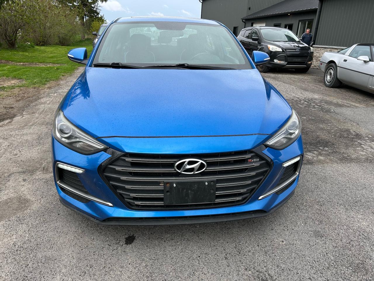 2017 Hyundai Elantra Sport - Photo #4