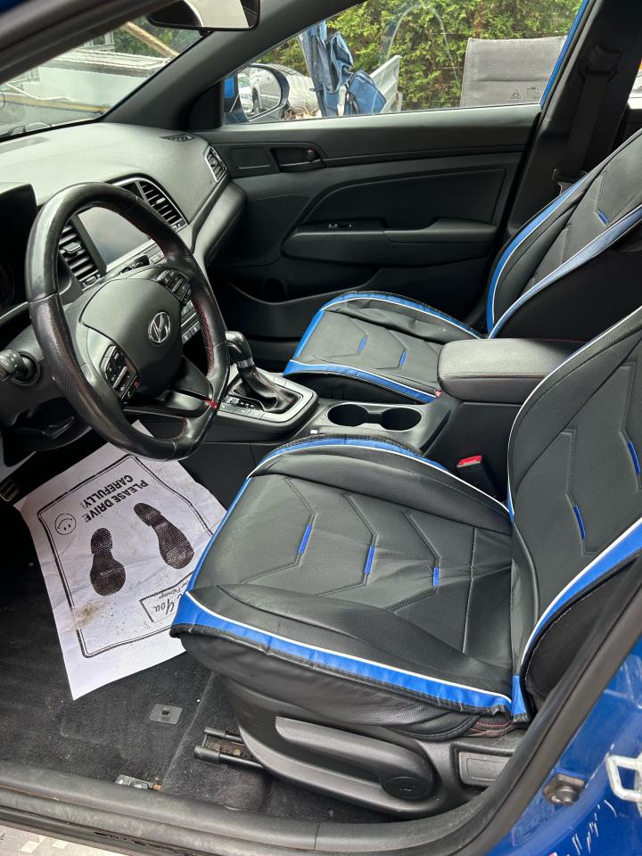 2017 Hyundai Elantra Sport - Photo #5