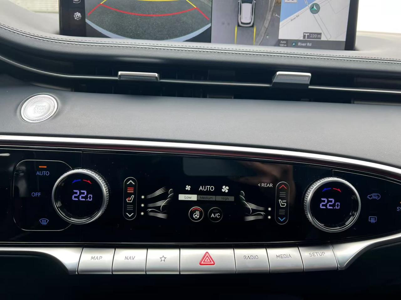 12538876
