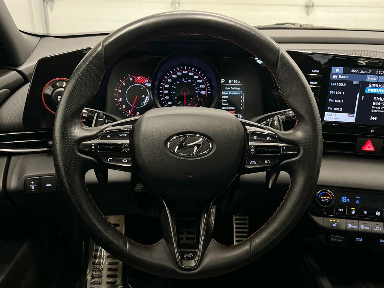 2022 Hyundai Elantra N LINE | ONLY 33,000KMS! | 200HP TURBO | SUNROOF Photo