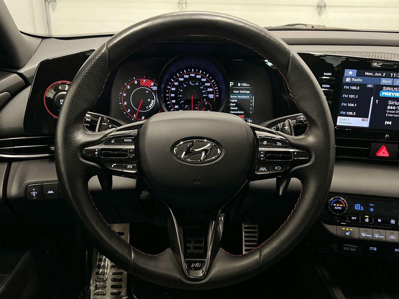2022 Hyundai Elantra N LINE | ONLY 33,000KMS! | 200HP TURBO | SUNROOF Photo