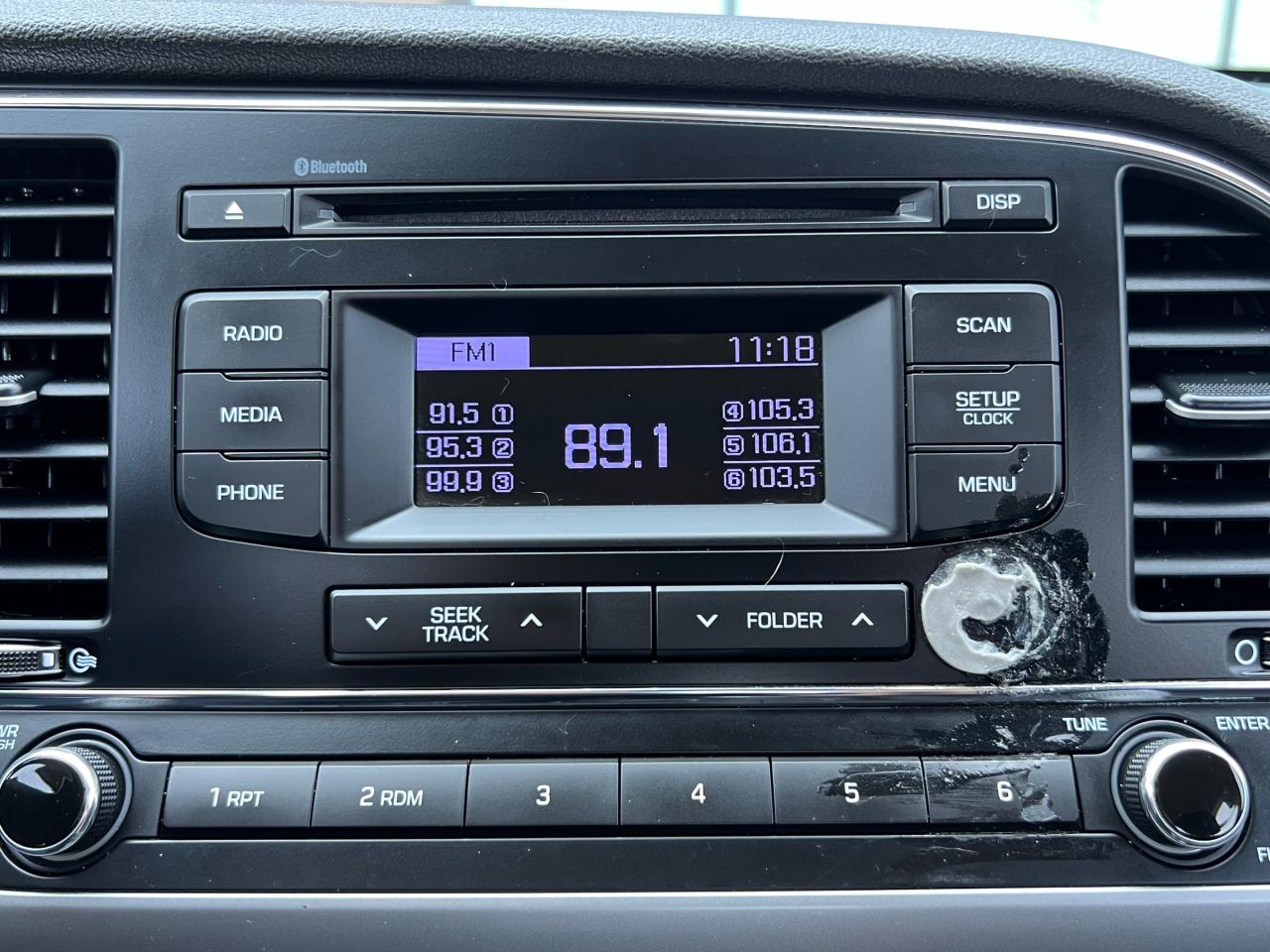 12571172