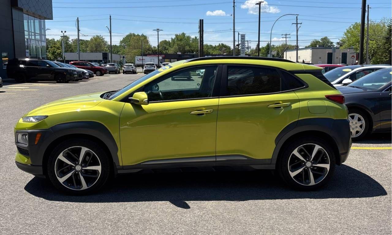 2018 Hyundai KONA 1.6T Ultimate AWD w/Colour Pack - Photo #2