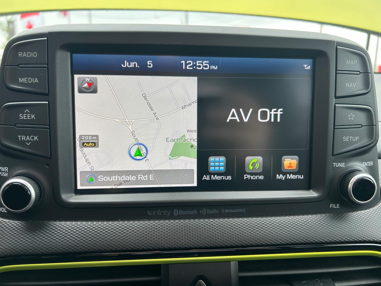 2018 Hyundai KONA 1.6T Ultimate AWD w/Colour Pack - Photo #14