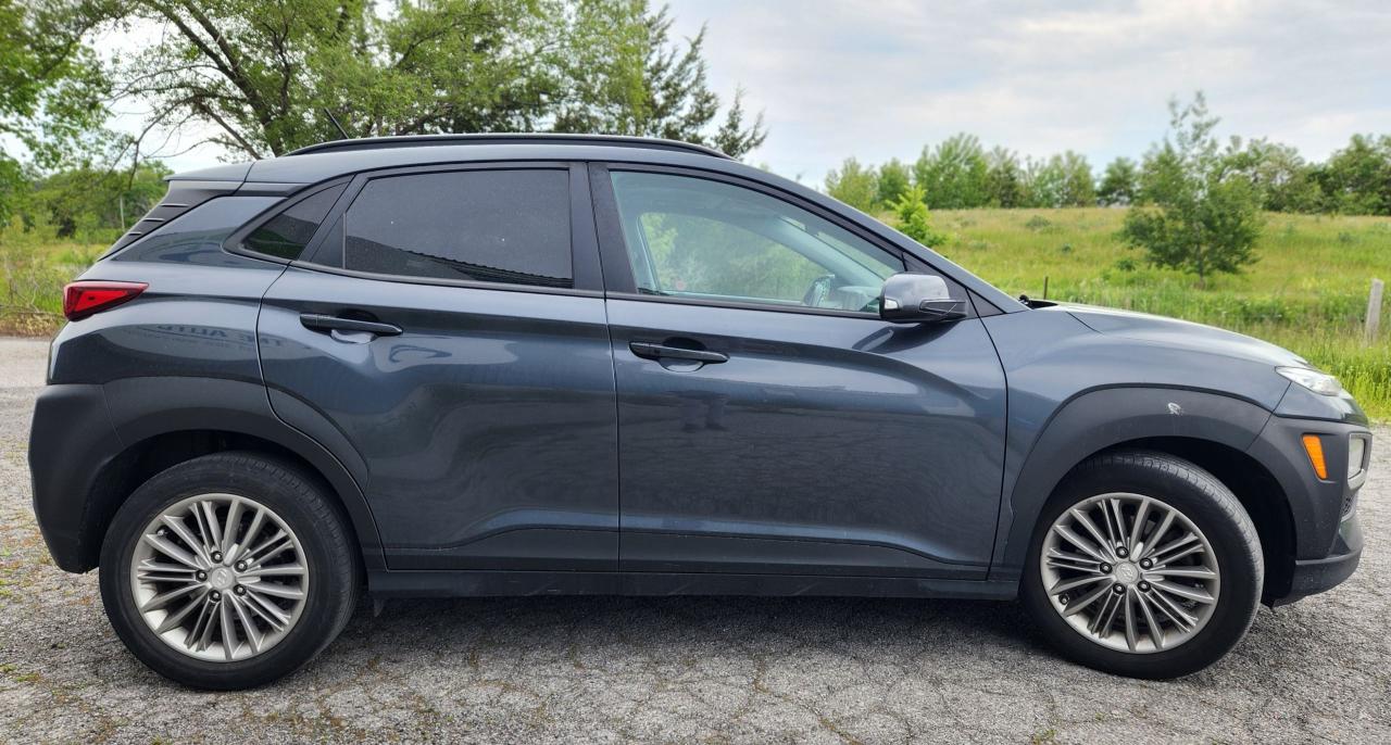 2018 Hyundai KONA LUXURY Photo3