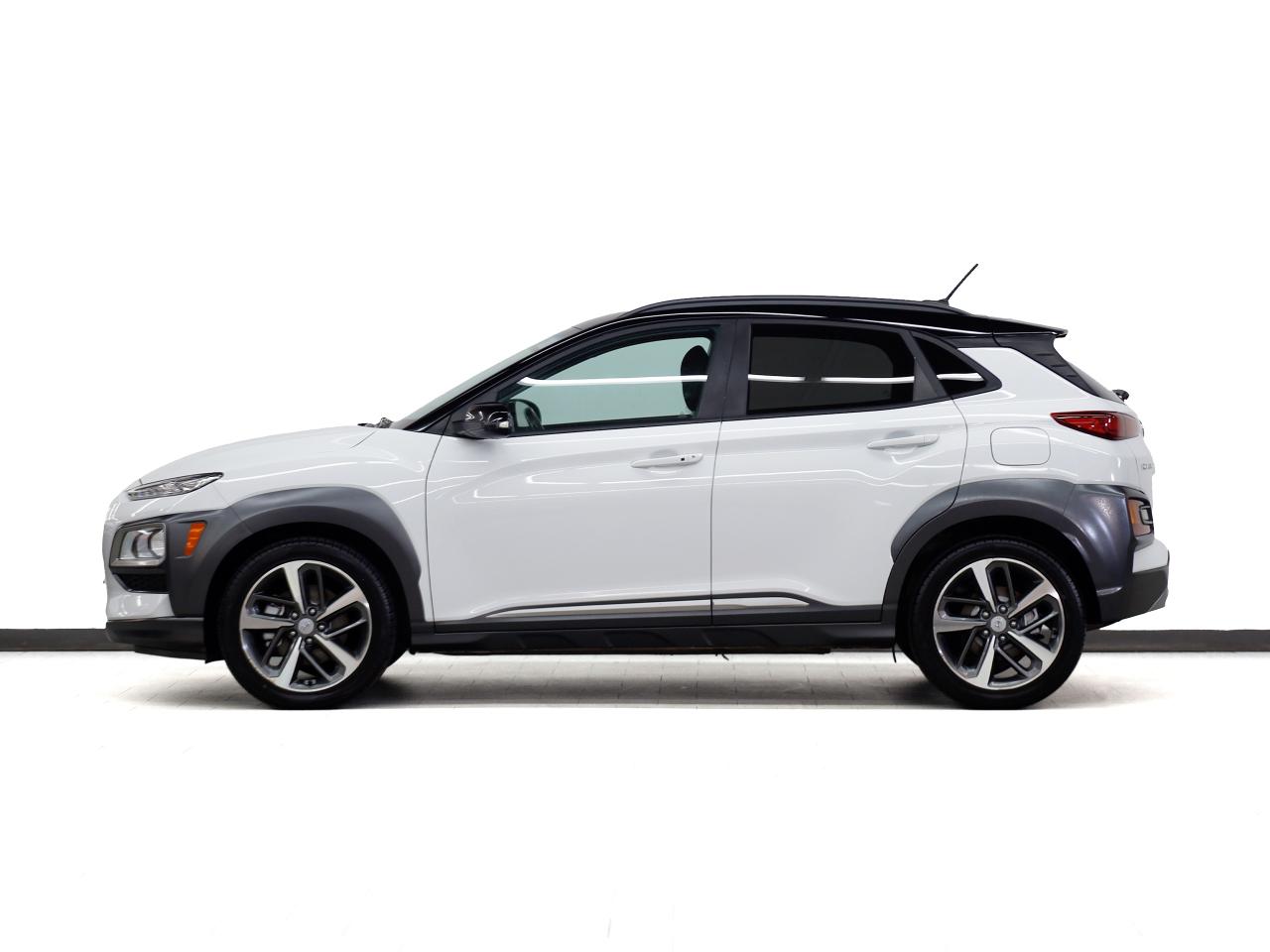 2021 Hyundai KONA ULTIMATE | AWD | Nav | Leather | Sunroof | CarPlay