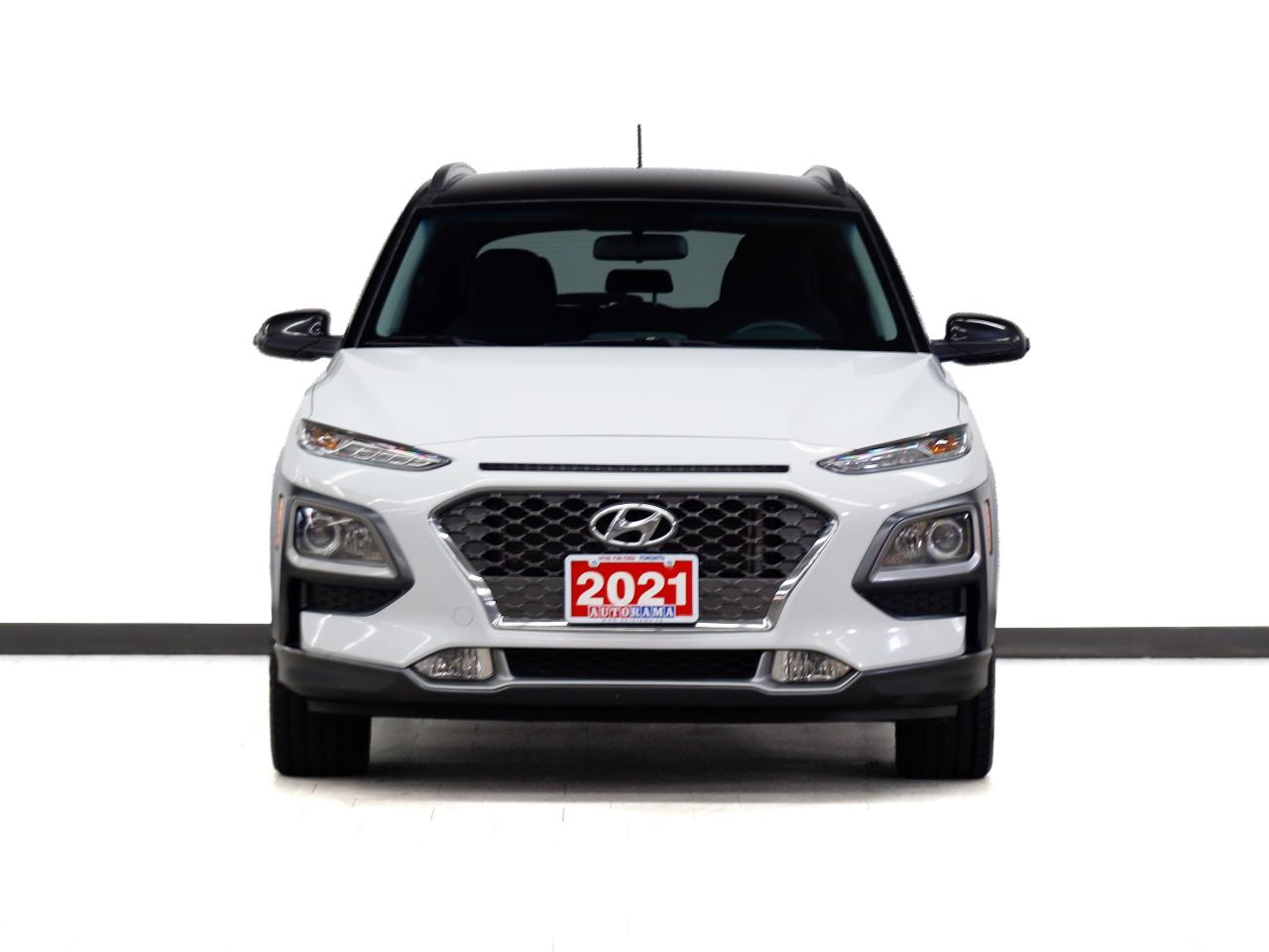2021 Hyundai KONA ULTIMATE | AWD | Nav | Leather | Sunroof | CarPlay