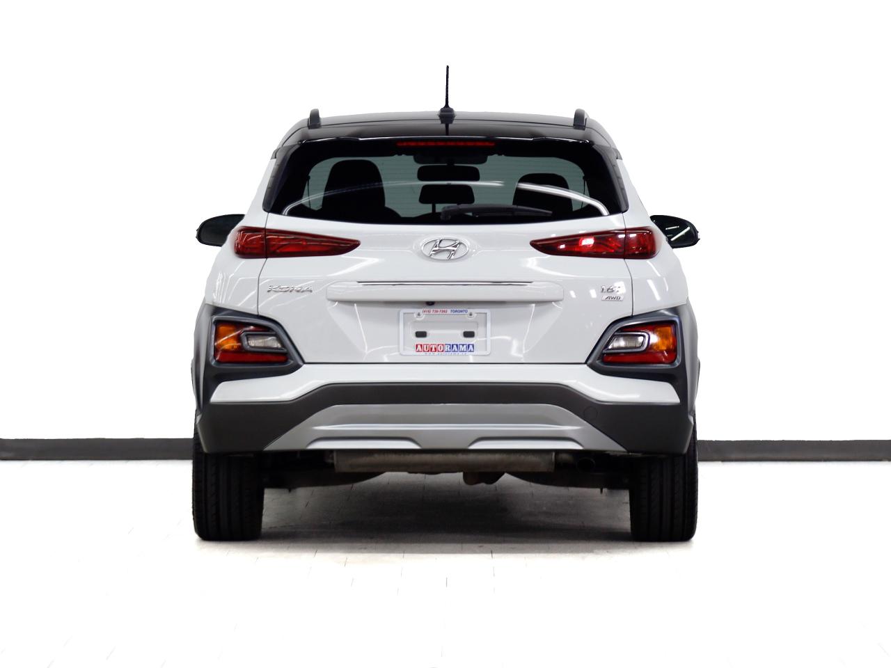 2021 Hyundai KONA ULTIMATE | AWD | Nav | Leather | Sunroof | CarPlay