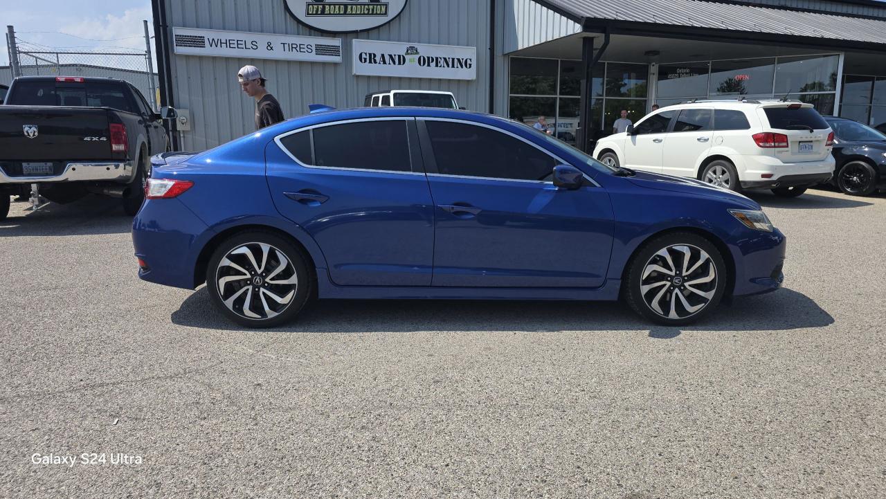 2017 Acura ILX Anniversary Edition - Photo #6