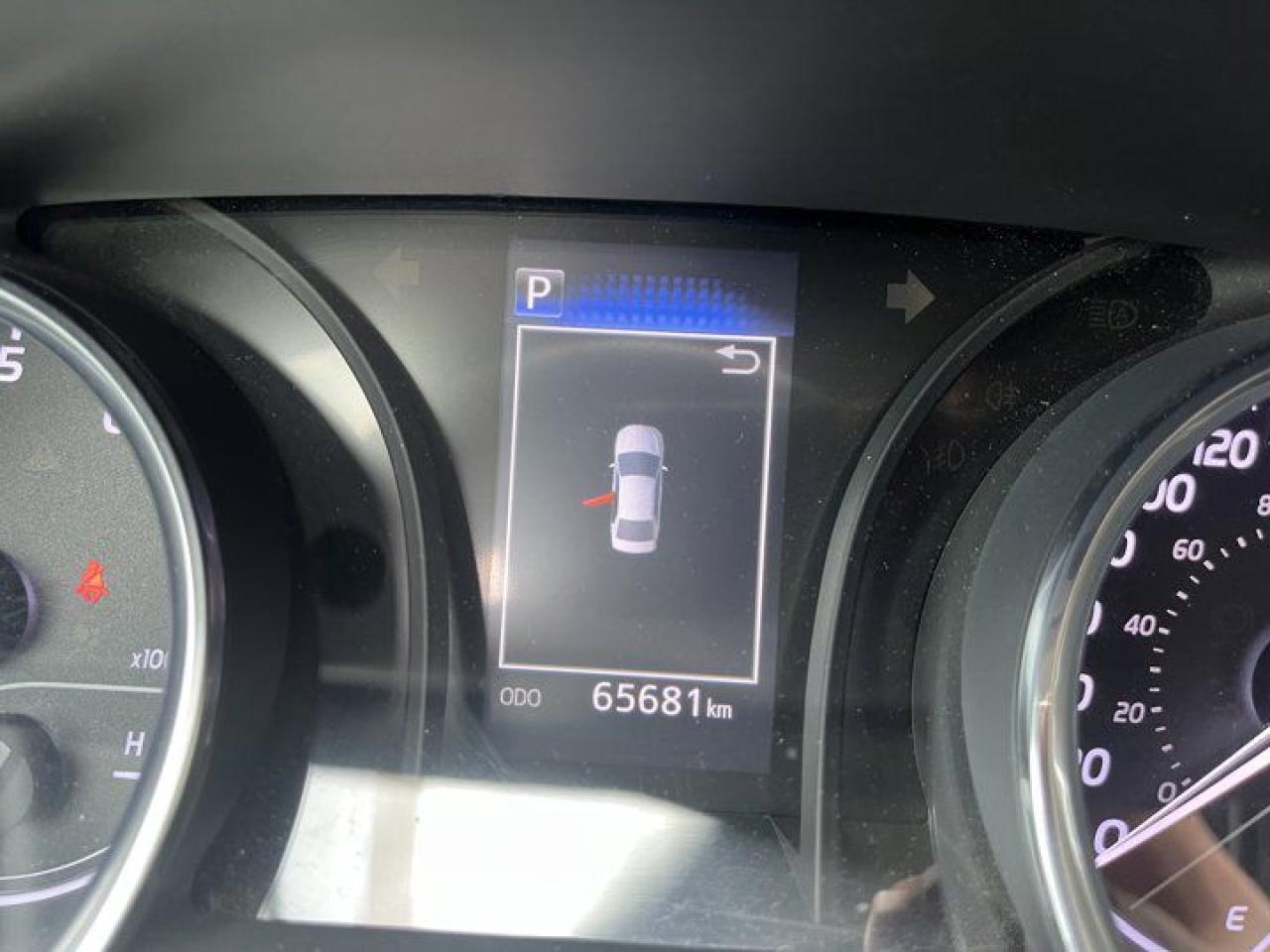 12710982