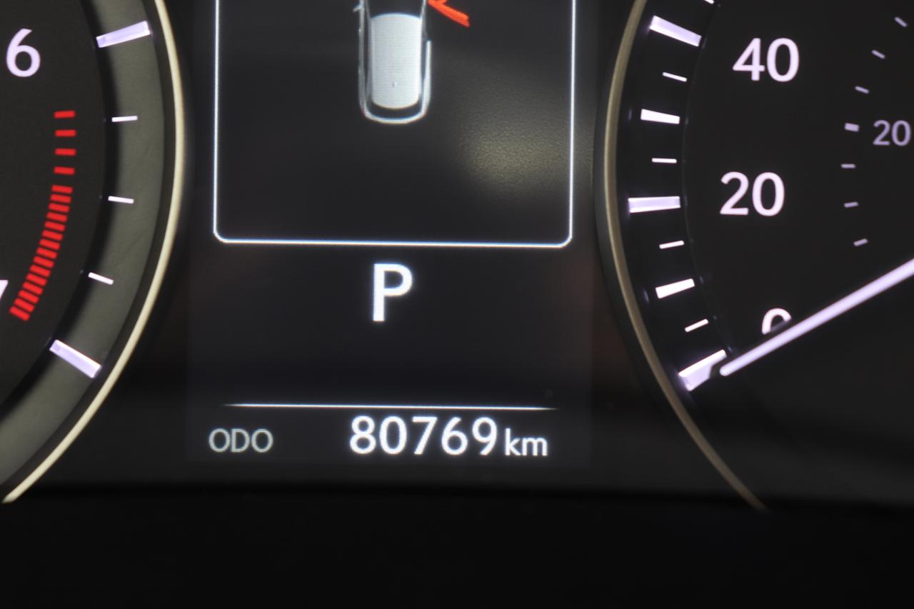 12715287