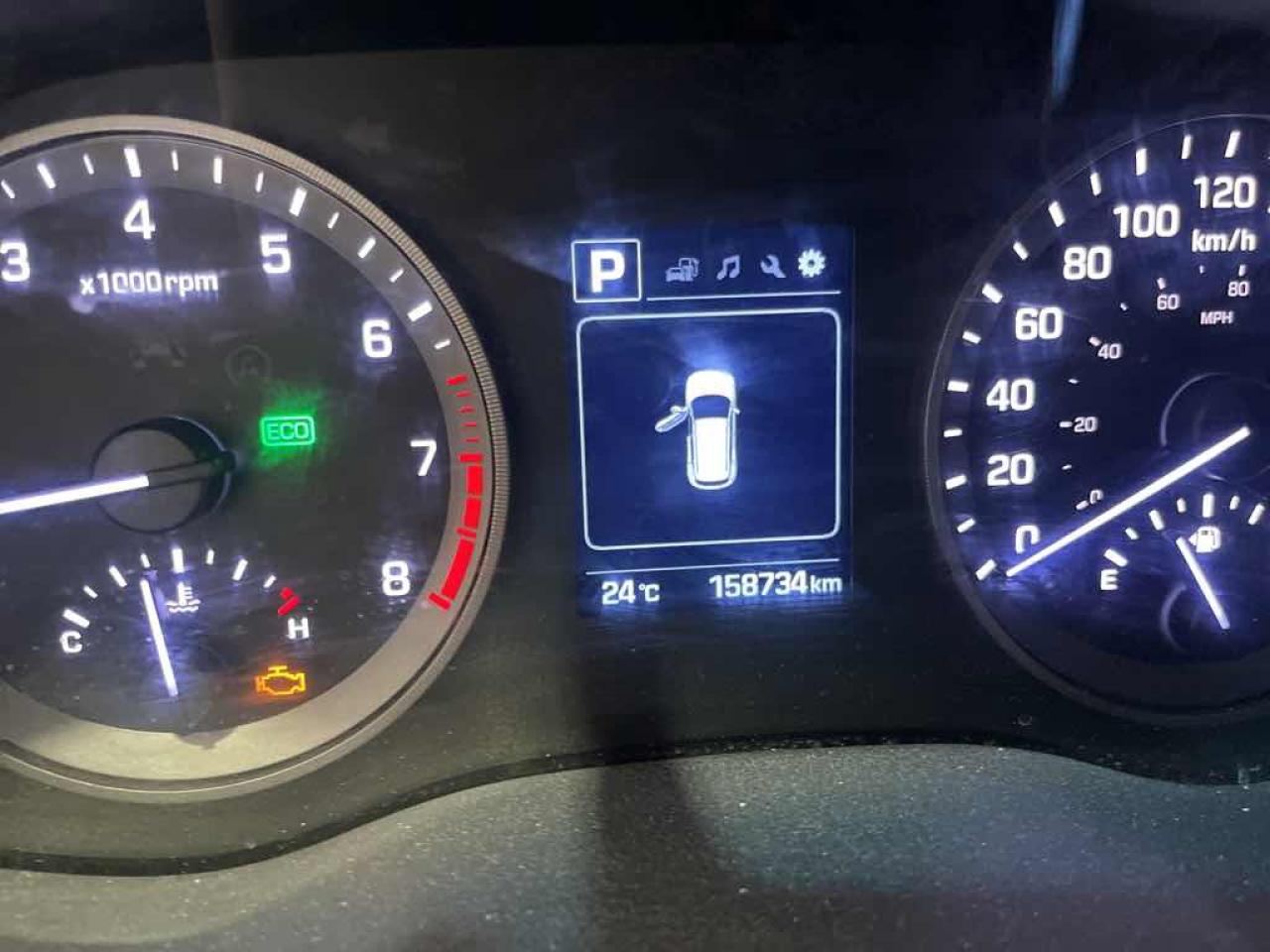 12760152