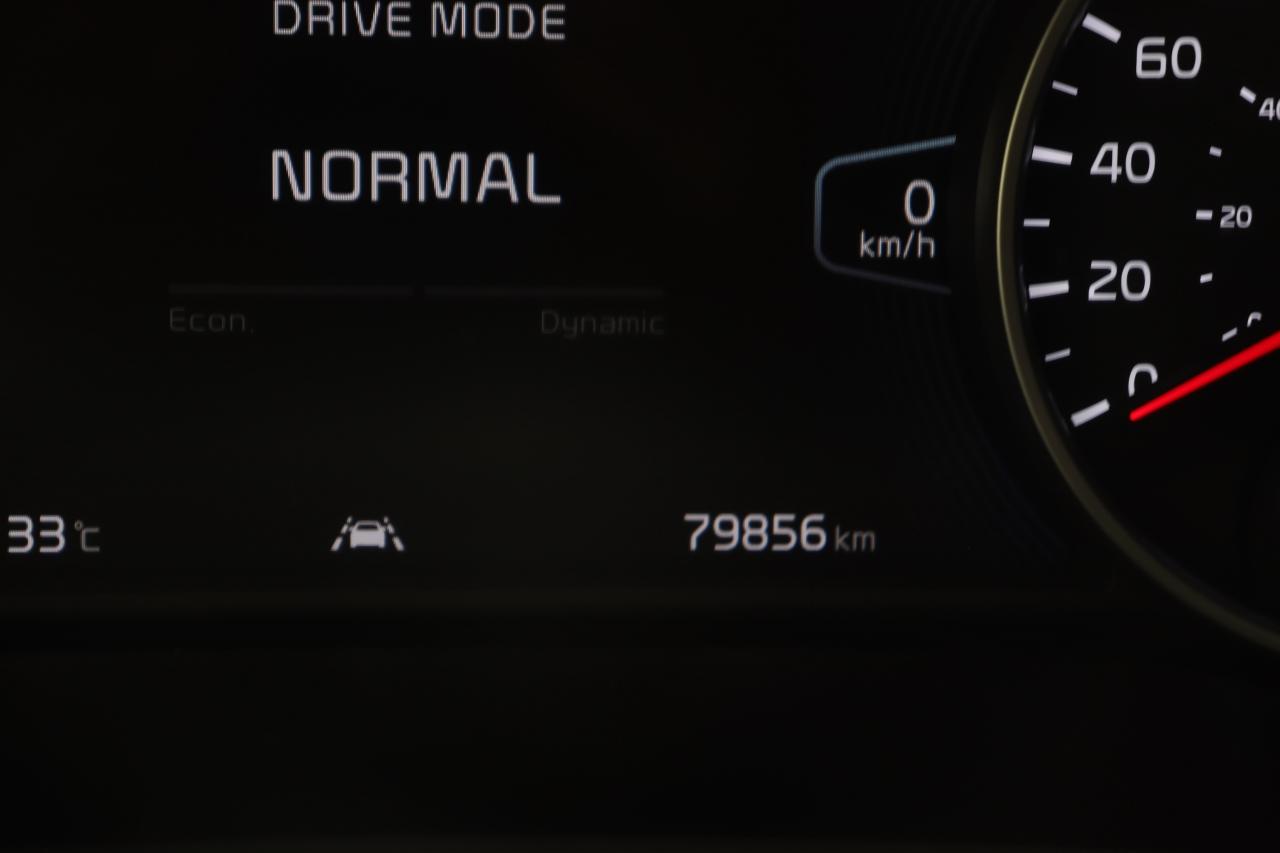 12855416