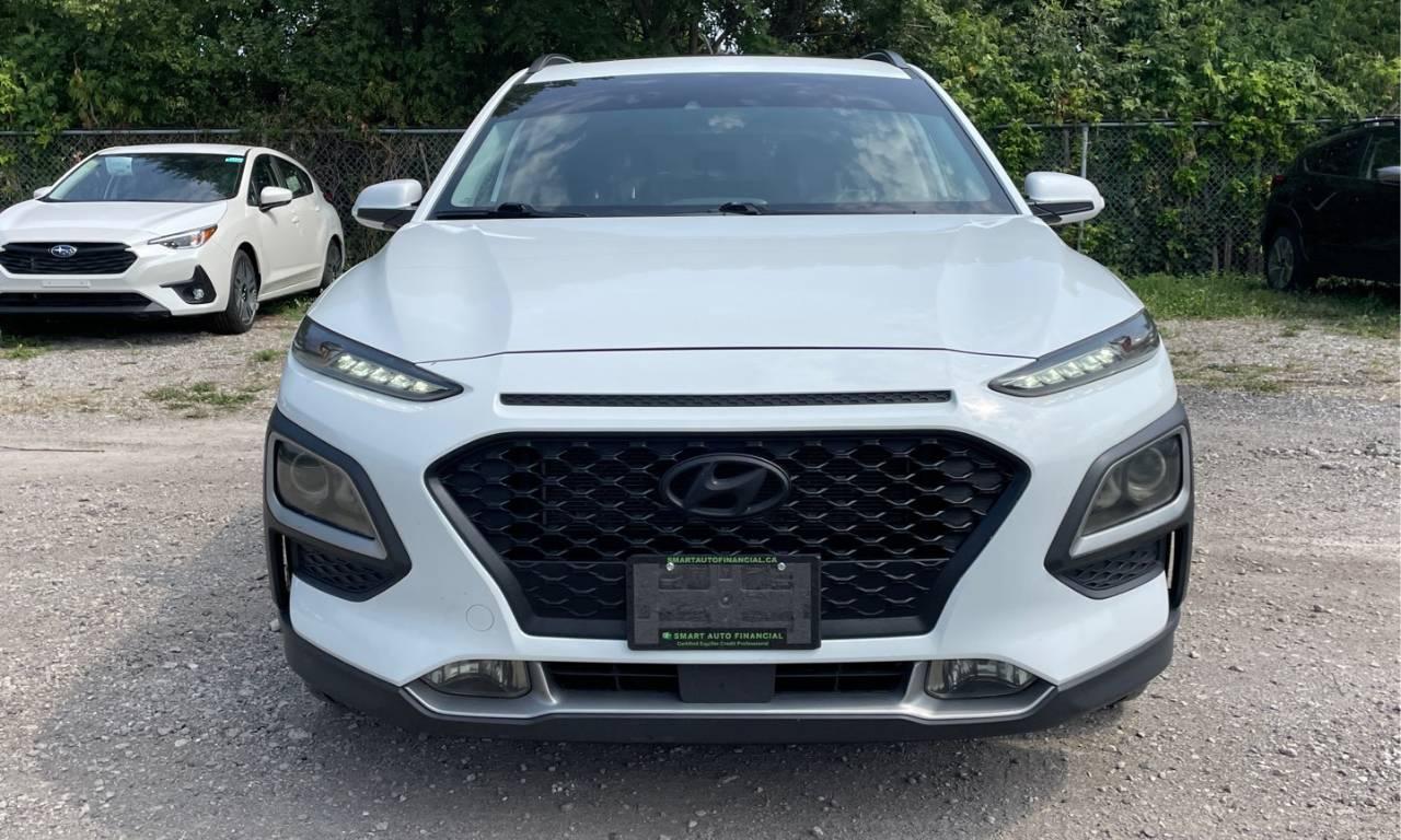 2018 Hyundai KONA LUXURY - Photo #4