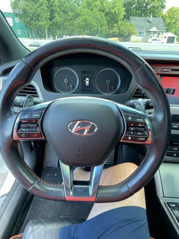 2016 Hyundai Sonata 2.0T Sport Ultimate w/Colour Pack - Photo #5