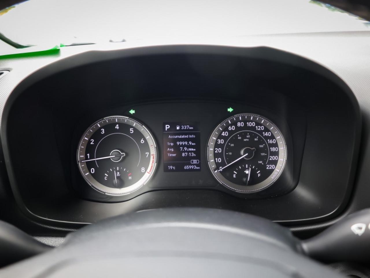 2022 Hyundai Venue Ultimate w/Denim Interior  - $151 B/W Photo