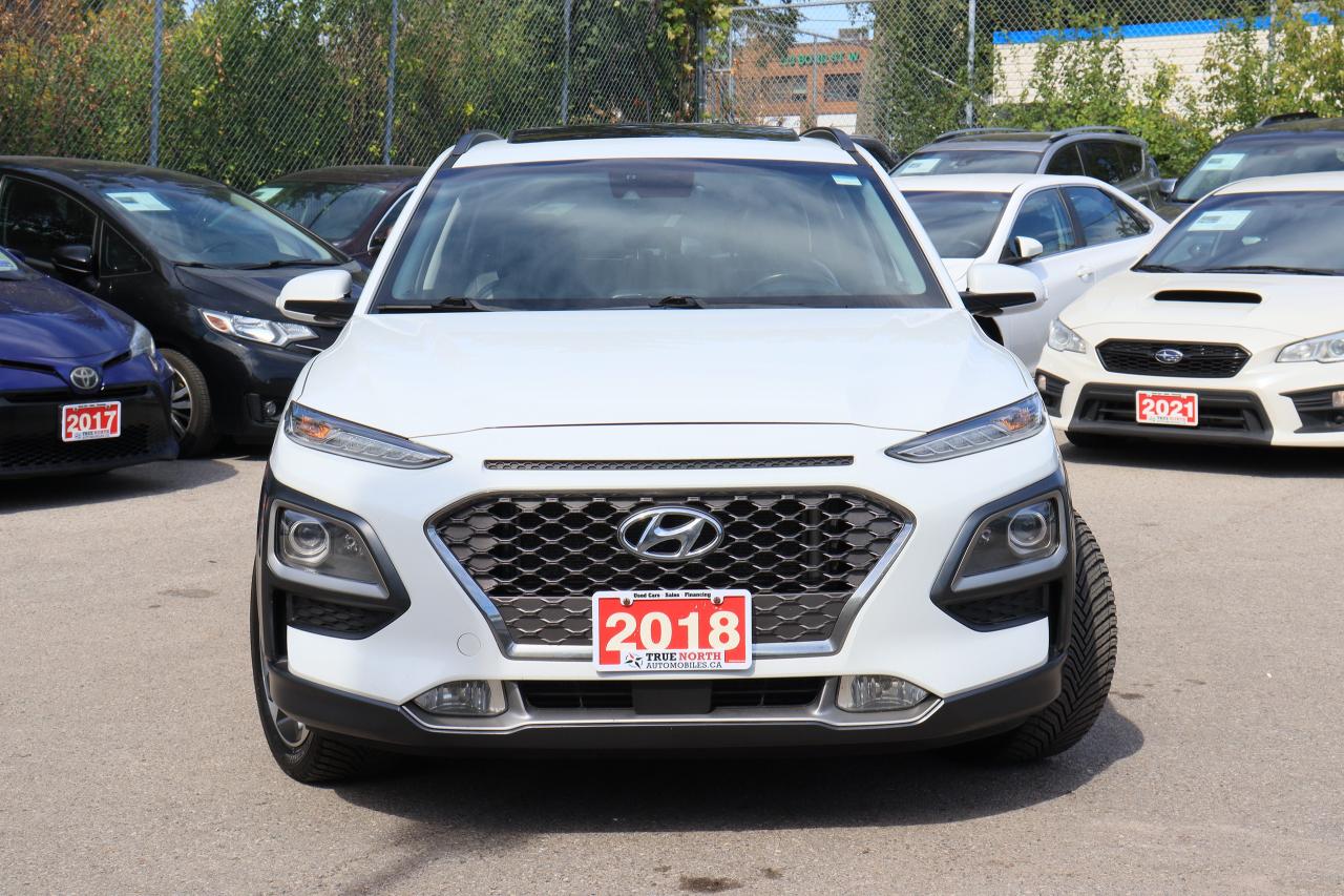 2018 Hyundai KONA Ultimate | AWD | Leather | Roof | Nav | Cam | BSM Photo3