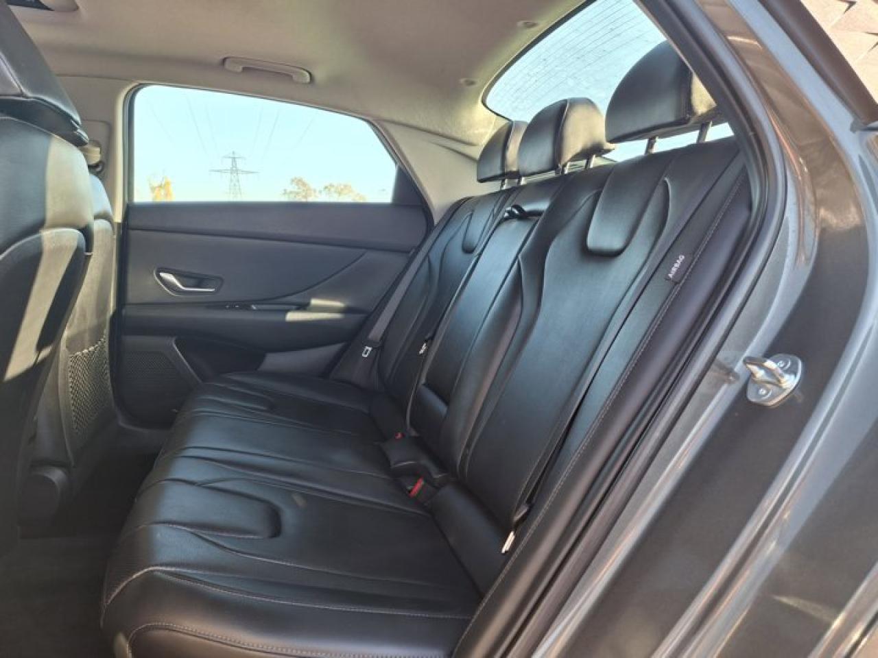 2025 Hyundai Elantra Luxury | Leather | Sunroof | Nav | Adaptive Cruise | CarPlay | Android Auto | and More ! Photo