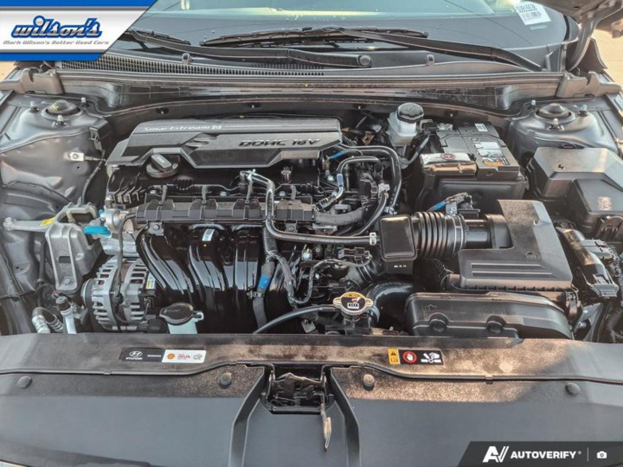 2025 Hyundai Elantra Luxury | Leather | Sunroof | Nav | Adaptive Cruise | CarPlay | Android Auto | and More ! Photo