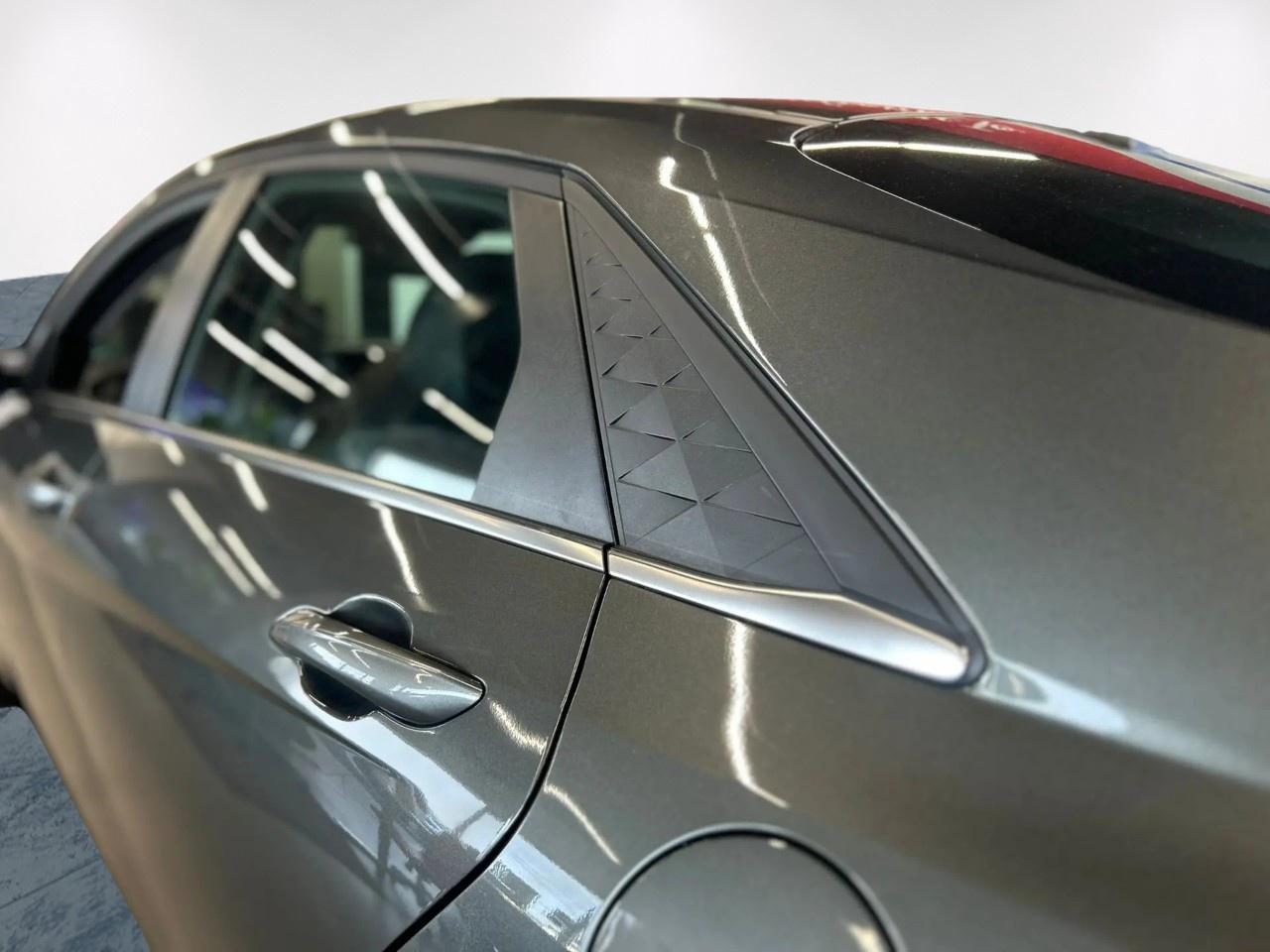 2025 Hyundai Elantra SEL Photo