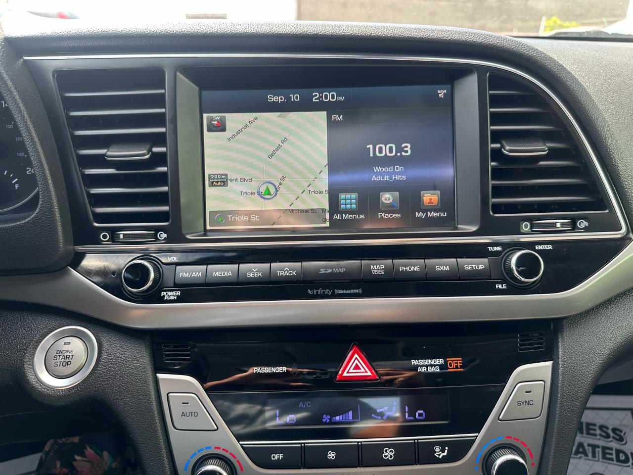 2017 Hyundai Elantra Limited SE - Photo #17