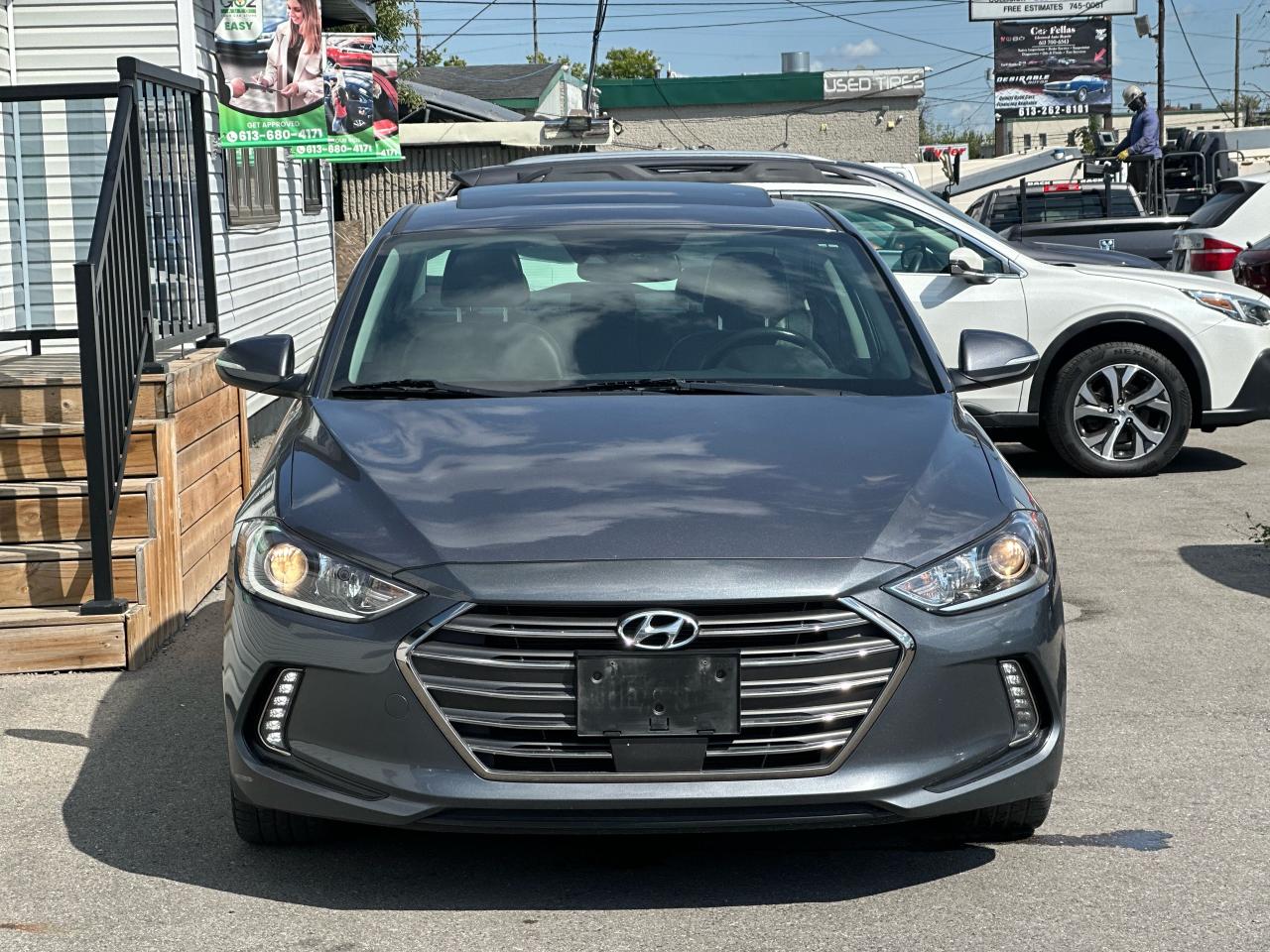 2017 Hyundai Elantra Limited SE - Photo #5