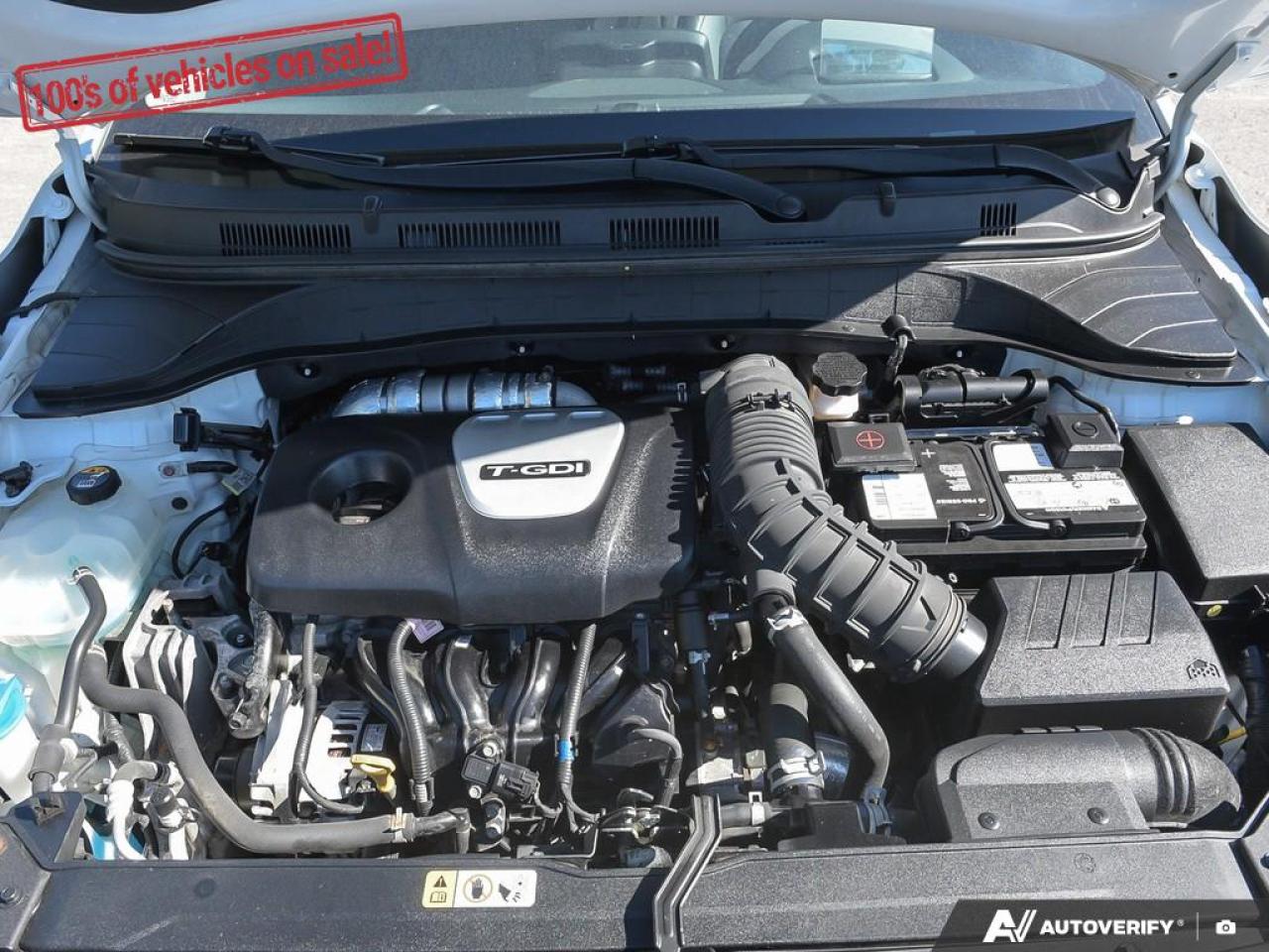 2018 Hyundai KONA Ultimate