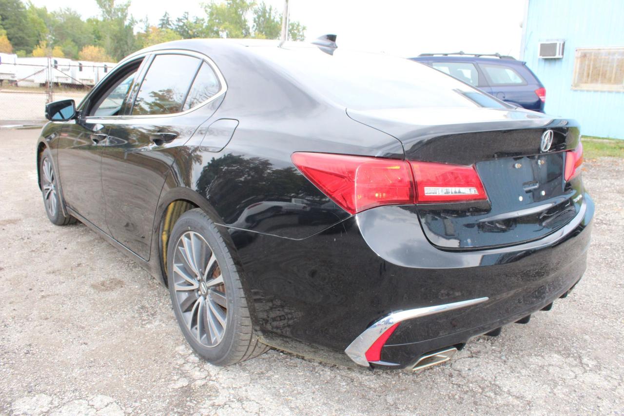2018 Acura TLX Tech Photo3