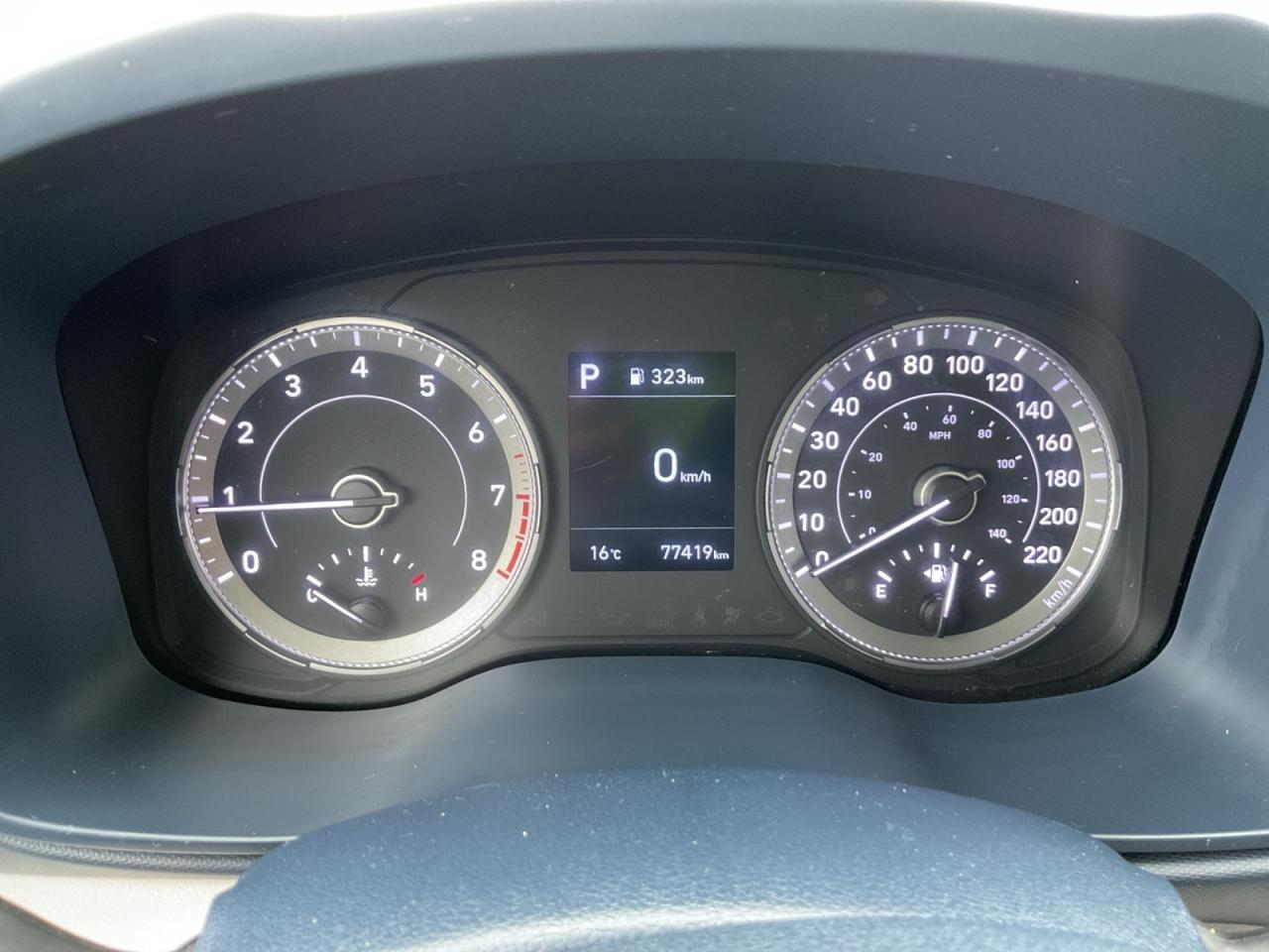 2021 Hyundai Venue 1.6L Trend! Great Kms! One Owner! Photo